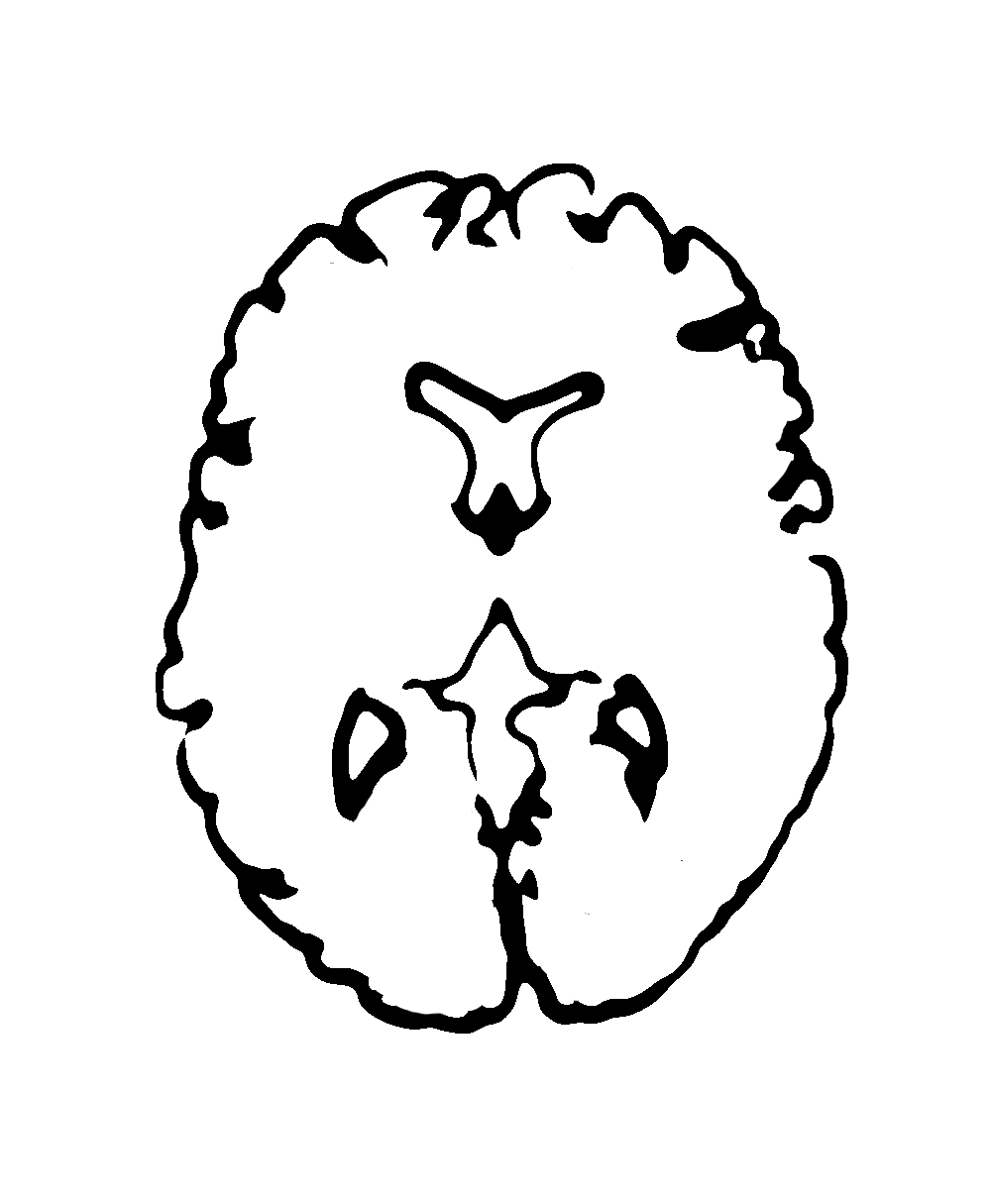 Black line drawing of an axial (horizontal) brain slice outline.